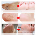 Exfoliating Foot Mask Socks Pedicure Foot Care